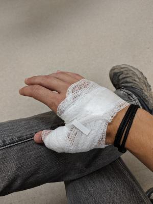 Bandages on my hand